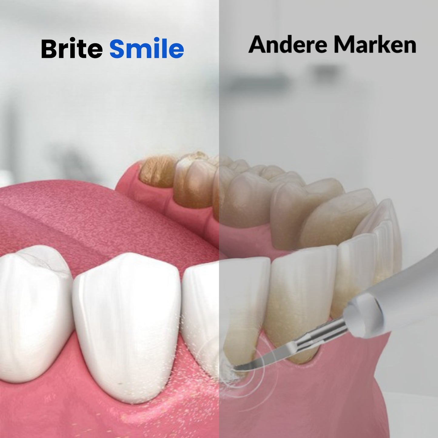 Brite Smile | Direkt weißere Zähne